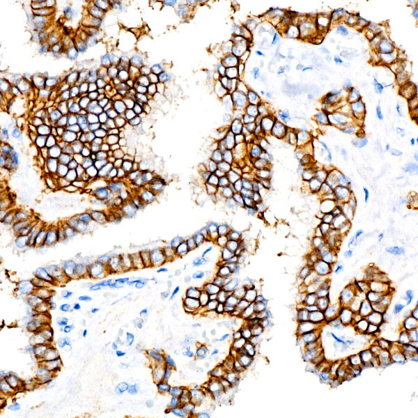 EpCAM Rabbit mAb