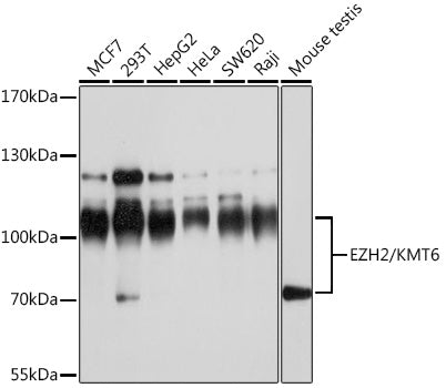 EZH2/KMT6 Rabbit pAb