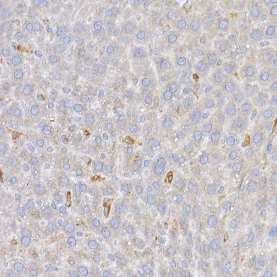 Heme Oxygenase 1 (HO-1/HMOX1) Rabbit pAb