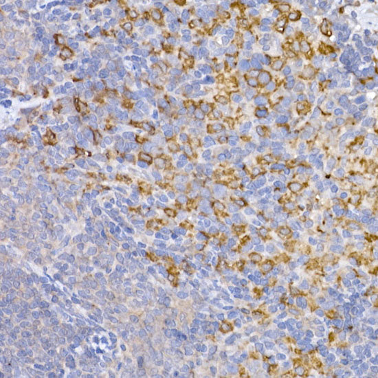 Heme Oxygenase 1 (HO-1/HMOX1) Rabbit pAb