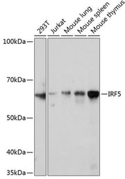 IRF5 Rabbit mAb