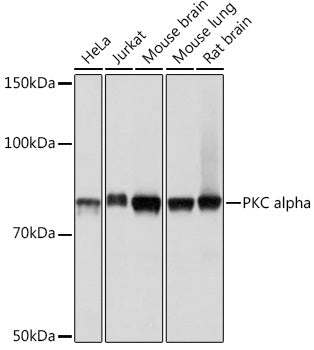 PKC alpha Rabbit mAb