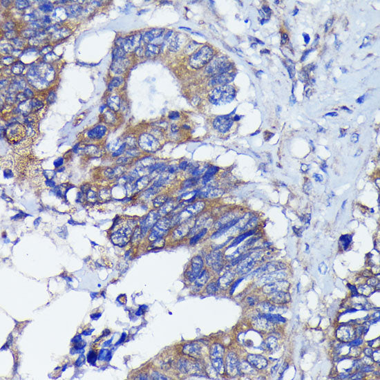 PKC alpha Rabbit mAb