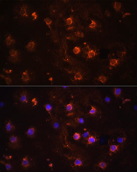IL1β Rabbit pAb