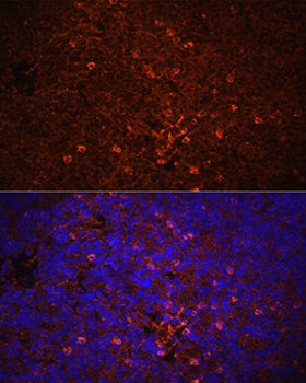 IL1β Rabbit pAb