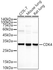 [KO Validated] CDK4 Rabbit mAb