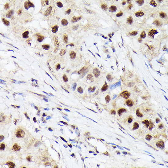 [KO Validated] CDK4 Rabbit mAb