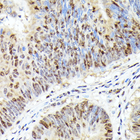 [KO Validated] CDK4 Rabbit mAb