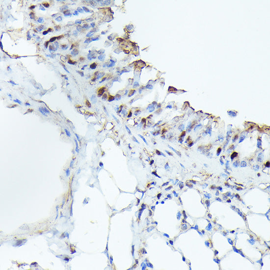 [KO Validated] CDK4 Rabbit mAb