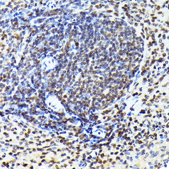 [KO Validated] CDK4 Rabbit mAb