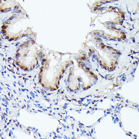 [KO Validated] CDK4 Rabbit mAb