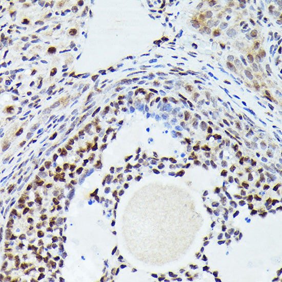 [KO Validated] CDK4 Rabbit mAb