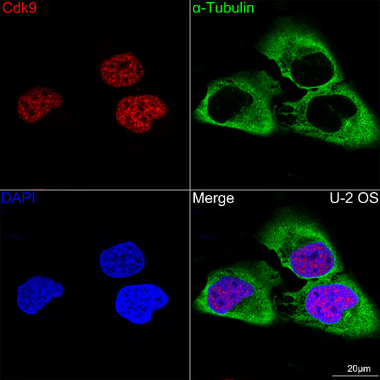 [KO Validated] CDK9 Rabbit mAb