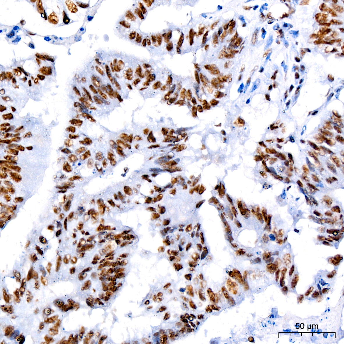 [KO Validated] CDK9 Rabbit mAb