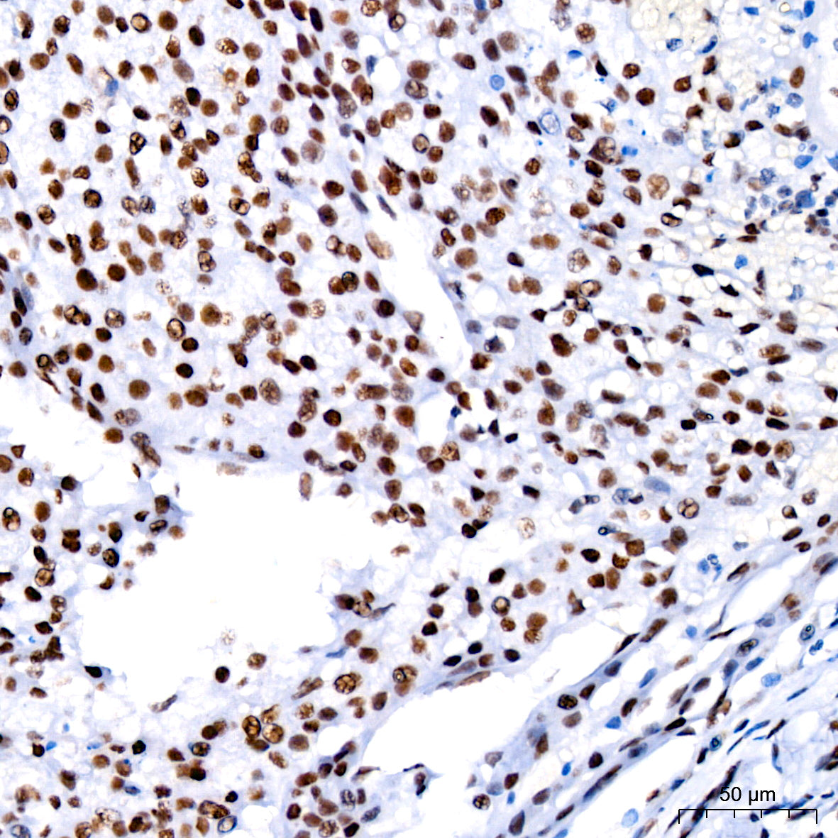 [KO Validated] CDK9 Rabbit mAb