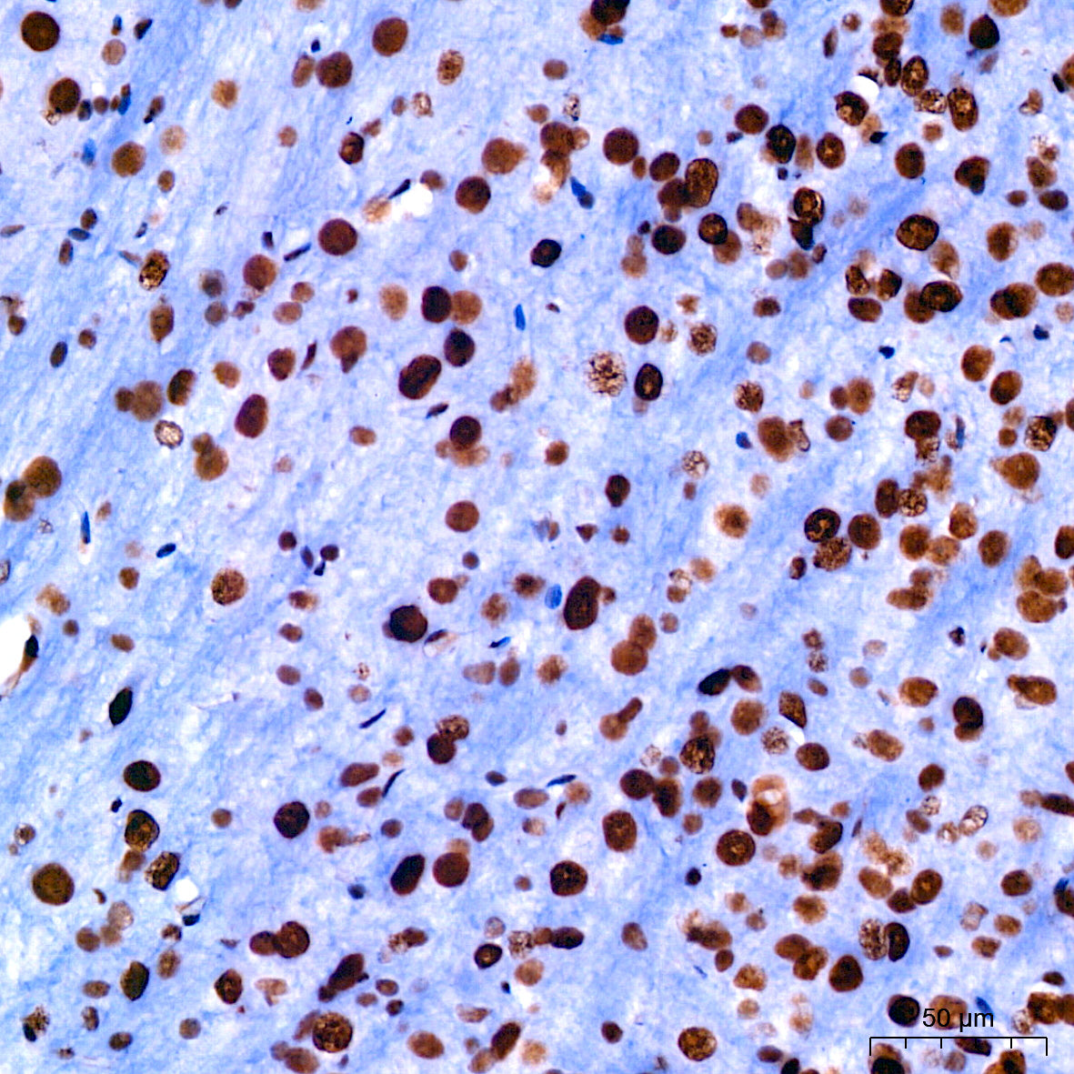 [KO Validated] CDK9 Rabbit mAb