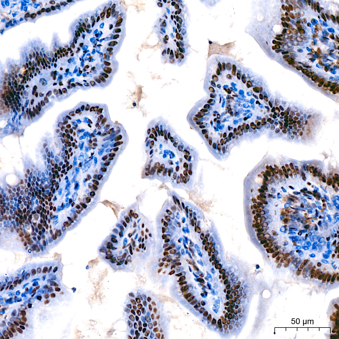 [KO Validated] CDK9 Rabbit mAb
