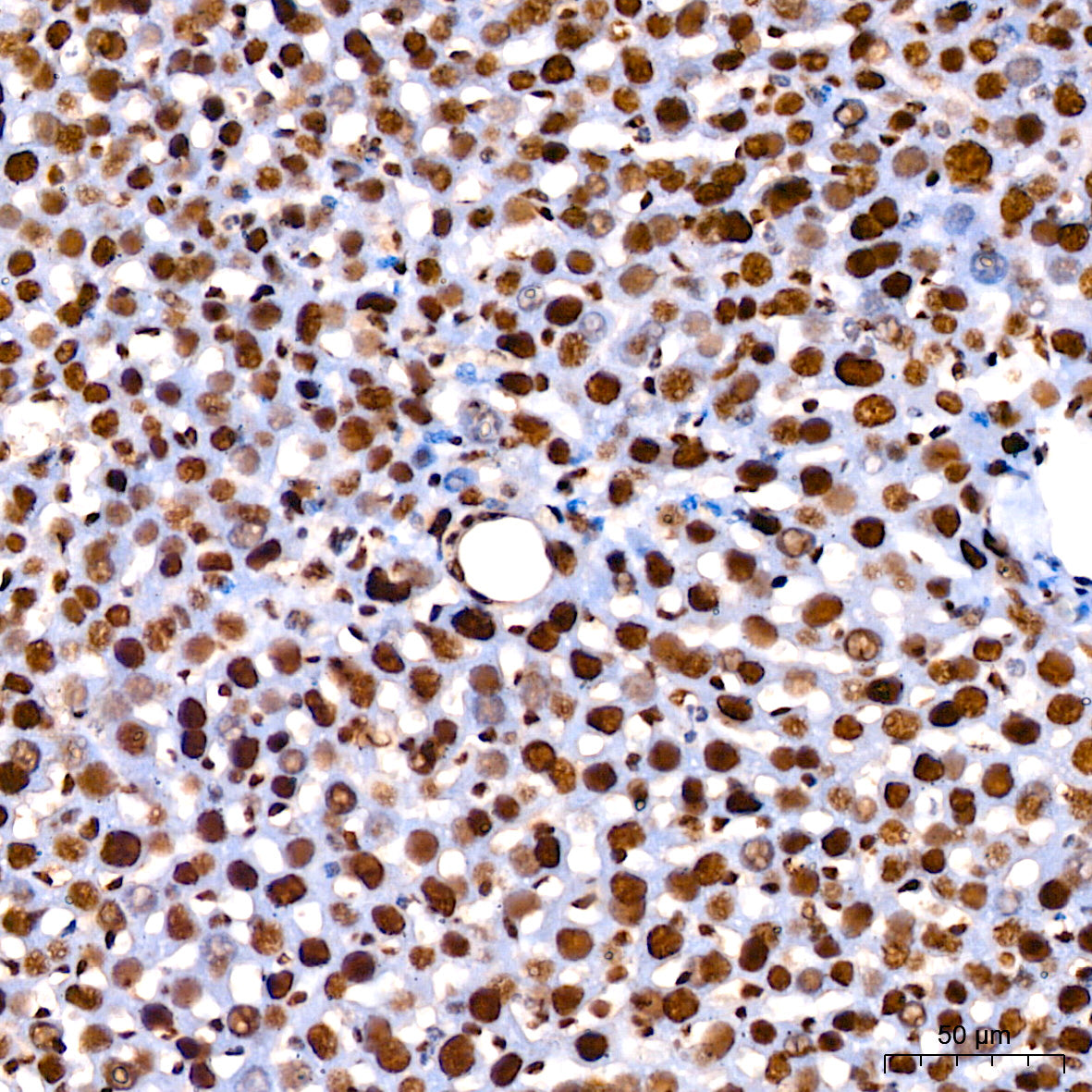 [KO Validated] CDK9 Rabbit mAb
