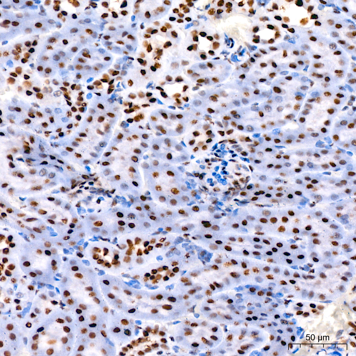 [KO Validated] CDK9 Rabbit mAb
