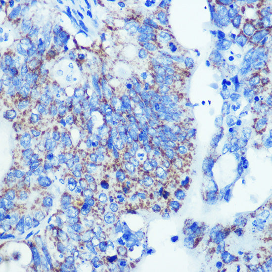 MMP13 Rabbit mAb