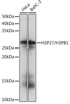 HSP27/HSPB1 Rabbit mAb