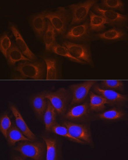 HSP27/HSPB1 Rabbit mAb