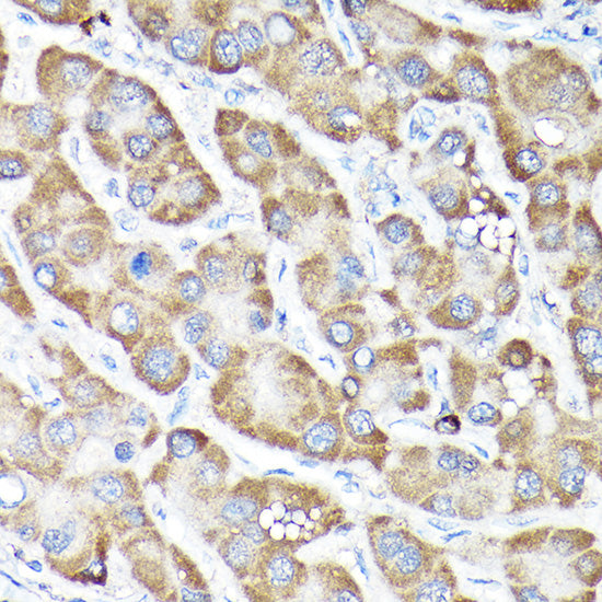 NRF2 Rabbit pAb