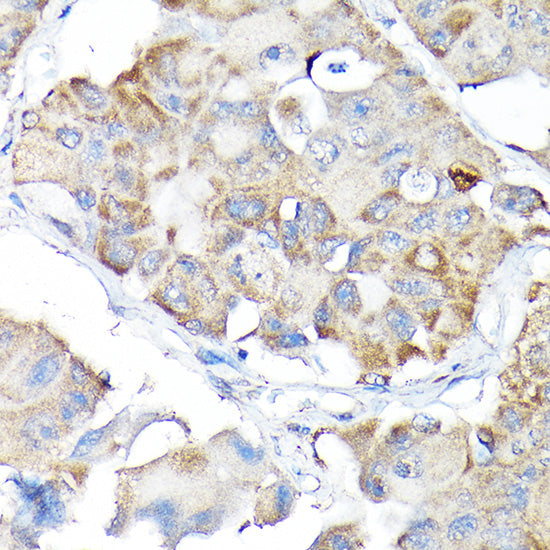NRF2 Rabbit pAb