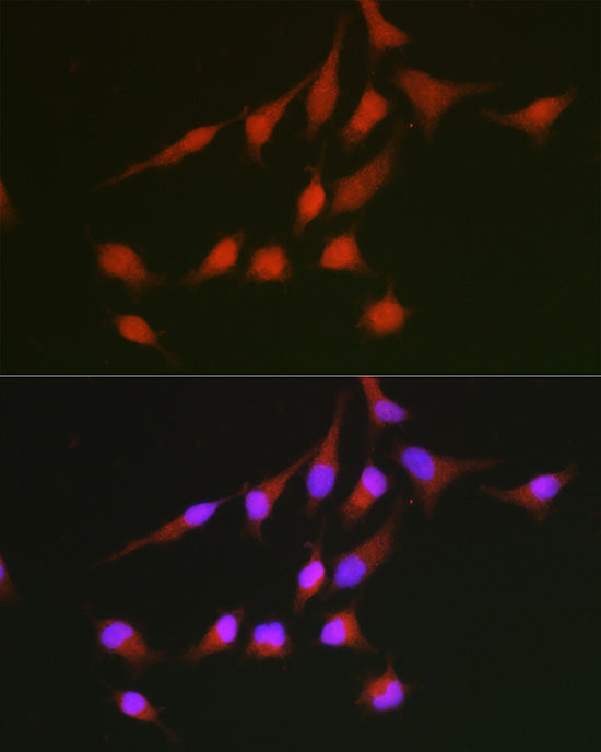 NRF2 Rabbit pAb