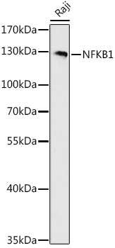 NFKB1 Rabbit pAb