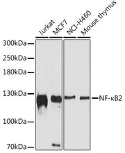 NF-κB2 Rabbit pAb