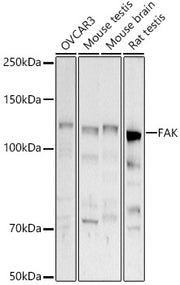 [KD Validated] FAK Rabbit pAb