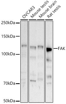 [KD Validated] FAK Rabbit pAb