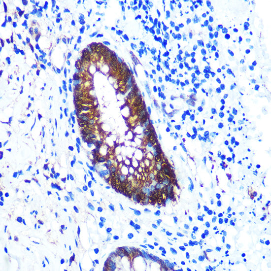 Galectin 3/LGALS3 Rabbit mAb