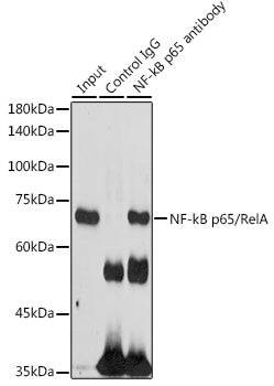 NF-kB p65/RelA Rabbit pAb