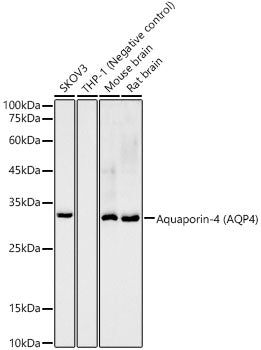 Aquaporin-4 (AQP4) Rabbit mAb
