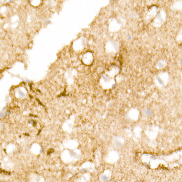 Aquaporin-4 (AQP4) Rabbit mAb