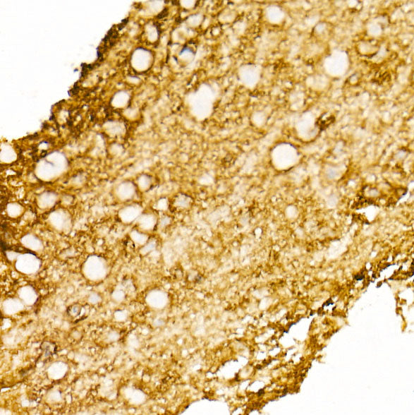 Aquaporin-4 (AQP4) Rabbit mAb