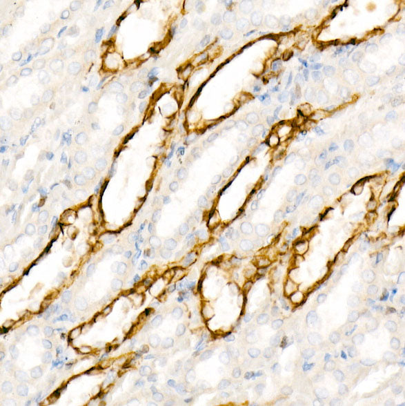 Aquaporin-4 (AQP4) Rabbit mAb