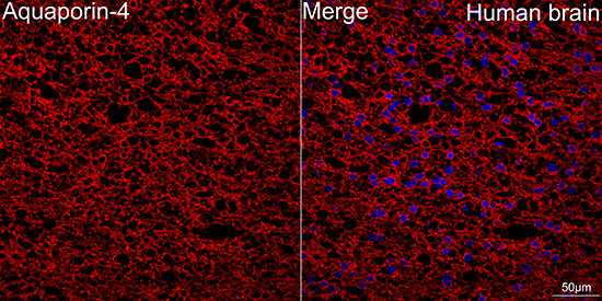 Aquaporin-4 (AQP4) Rabbit mAb