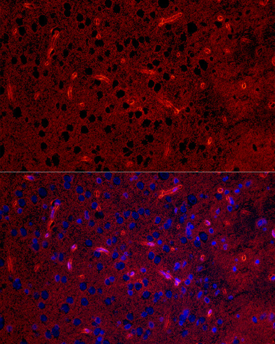 Aquaporin-4 (AQP4) Rabbit mAb