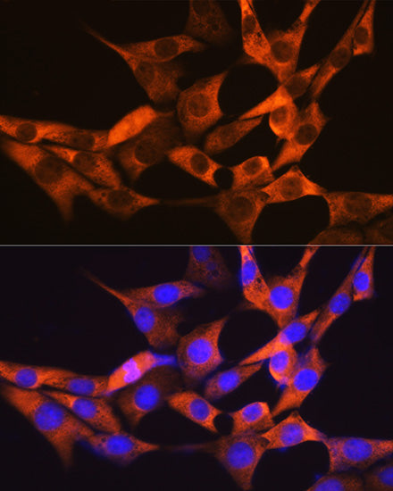 FABP1 Rabbit mAb