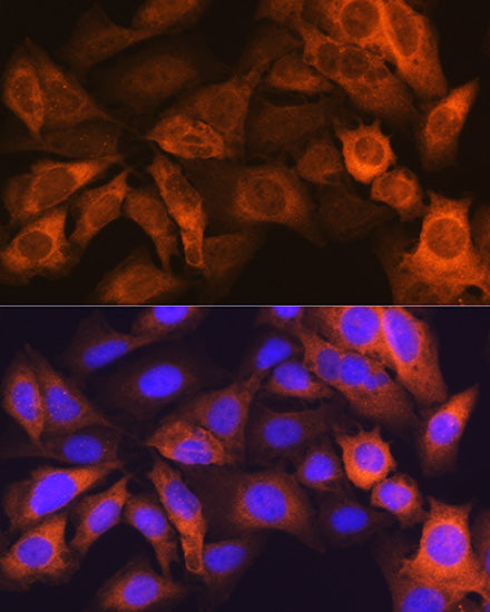 FABP1 Rabbit mAb