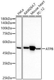 ATPB Rabbit mAb