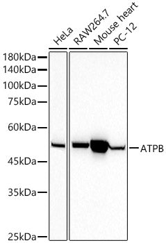 ATPB Rabbit mAb