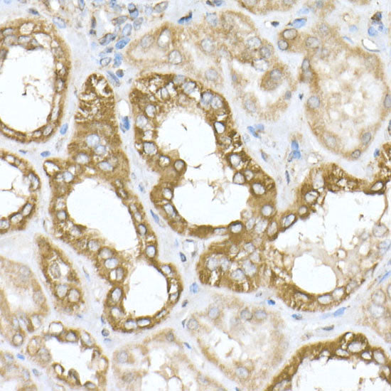 ATPB Rabbit mAb
