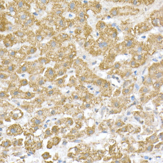 ATPB Rabbit mAb