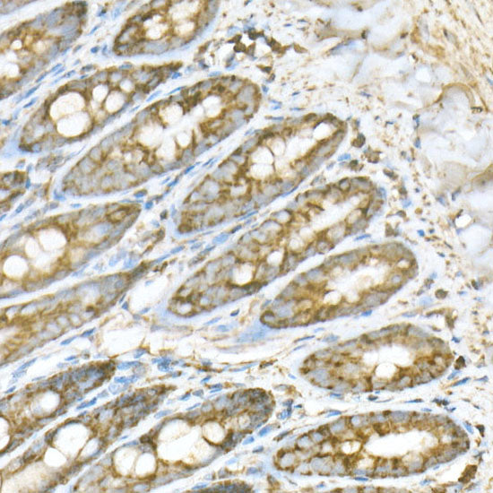 ATPB Rabbit mAb