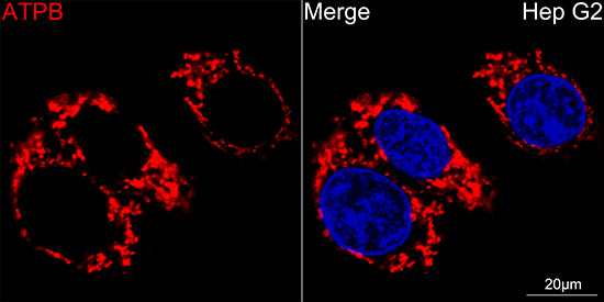 ATPB Rabbit mAb