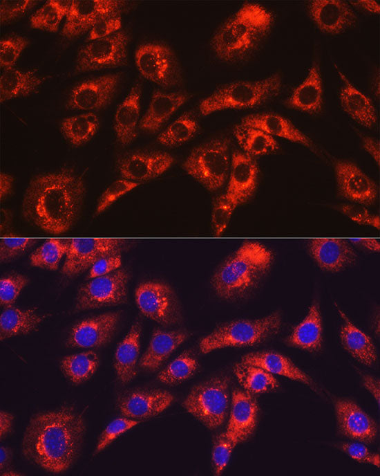 ATPB Rabbit mAb
